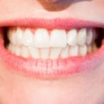Zdrowe i mocne zęby bez próchnicy – zadbaj o nie już teraz. Ból zębów – leczenie oraz profilaktyka